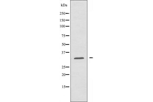 AIG1 Antikörper  (C-Term)