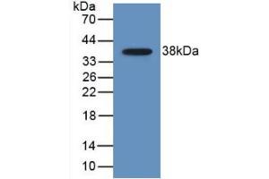 Western blot analysis of recombinant Human MDC. (CCL22 Antikörper  (AA 25-93))