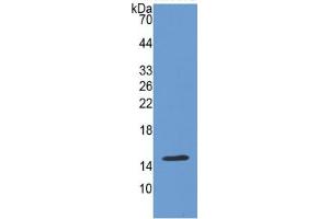WB of Protein Standard: different control antibodies  against Highly purified E. (Cadherin 13 ELISA Kit)