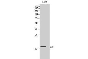 Western Blotting (WB) image for anti-Jumping Translocation Breakpoint (JTB) (N-Term) antibody (ABIN3175743) (JTB Antikörper  (N-Term))