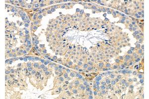 ABIN6262378 and ABIN6276997 at 1/100 staining Mouse testis tissue by IHC-P. (HSD17B2 Antikörper  (C-Term))