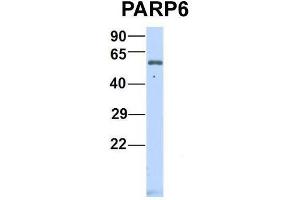 Host:  Rabbit  Target Name:  P Sample Type:  Human Fetal Heart  Antibody Dilution:  1. (PARP6 Antikörper  (N-Term))