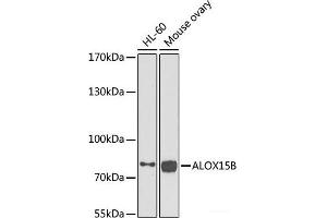 Western blot analysis of extracts of various cell lines using ALOX15B Polyclonal Antibody at dilution of 1:1000. (ALOX15B Antikörper)