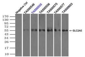 Image no. 3 for anti-Solute Carrier Family 2 (Facilitated Glucose/fructose Transporter), Member 5 (SLC2A5) antibody (ABIN1498479) (SLC2A5 Antikörper)