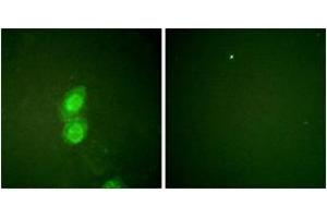 Immunofluorescence analysis of HuvEc cells, using Catenin-delta1 (Phospho-Tyr228) Antibody. (CTNND1 Antikörper  (pTyr228))