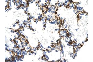Rabbit Anti-NMI antibody        Paraffin Embedded Tissue:  Human Lung cell   Cellular Data:  Epithelial cells of renal tubule  Antibody Concentration:   4. (NMI Antikörper  (Middle Region))