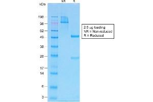 SDS-PAGE Analysis Purified PTH Rabbit Recombinant Monoclonal Antibody (PTH/1717R). (Rekombinanter PTH Antikörper  (AA 1-34))