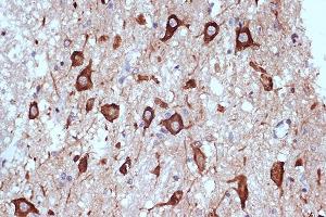 Immunohistochemistry of paraffin-embedded human brain using PRKRA/PACTRabbit mAb (ABIN7269666) at dilution of 1:100 (40x lens). (PRKRA Antikörper)