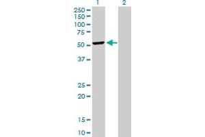 Western Blot analysis of DCTN2 expression in transfected 293T cell line by DCTN2 MaxPab polyclonal antibody. (Dynamitin Antikörper  (AA 1-401))