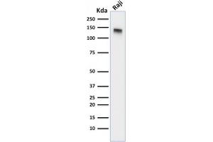 Western Blot Analysis of Raji cell lysate using CD22-Monospecific Mouse Monoclonal Antibody (BLCAM/1795). (CD22 Antikörper  (AA 52-178))