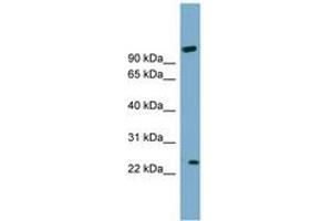 Image no. 1 for anti-ADP-Ribosylation Factor-Like 8A (ARL8A) (AA 71-120) antibody (ABIN6744124) (ARL8A Antikörper  (AA 71-120))