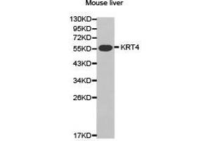 Western Blotting (WB) image for anti-Keratin 4 (KRT4) antibody (ABIN1873488) (KRT4 Antikörper)