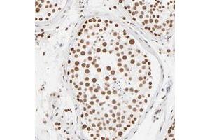 Immunohistochemical staining of human testis with ZNF540 polyclonal antibody  shows strong nuclear positivity in cells of seminiferus ducts. (ZNF540 Antikörper)