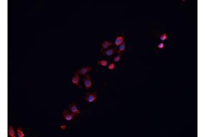 Immunofluorescence (fixed cells) (IF/ICC) image for anti-Nuclear Receptor Subfamily 0, Group B, Member 1 (NR0B1) (Internal Region) antibody (ABIN6263711)