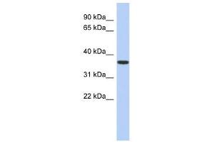 MVK antibody used at 1 ug/ml to detect target protein. (MVK Antikörper  (N-Term))