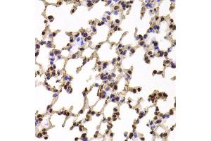 Immunohistochemistry of paraffin-embedded Mouse lung using KIF2B antibody at dilution of 1:100 (x400 lens). (KIF2B Antikörper)