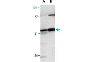 Western blot analysis of Casp12 in human (A) and mouse (B) spleen tissue lysates with Casp12 polyclonal antibody  at 1 ug/mL . (Caspase 12 Antikörper  (AA 2-17))