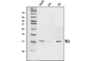 Western blot analysis of CFA/TBCA using anti-CFA/TBCA antibody (ABIN7598945).