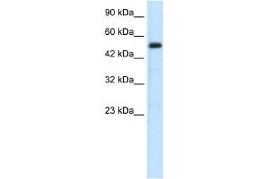 WB Suggested Anti-SMAD6 Antibody Titration:  0. (SMAD6 Antikörper  (N-Term))