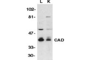 Image no. 1 for anti-DNA Fragmentation Factor, 40kDa, beta Polypeptide (Caspase-Activated DNase) (DFFB) (AA 314-329) antibody (ABIN201898) (DFFB Antikörper  (AA 314-329))