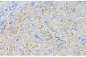 Immunohistochemistry of paraffin-embedded Rat ovary using ACADL Polyclonal Antibody at dilution of 1:100 (40x lens). (ACADL Antikörper)