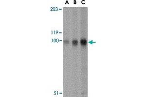 Western blot analysis of STIM2 in A-20 cell lysate with STIM2 polyclonal antibody  at (A) 0. (Stim2 Antikörper  (Internal Region))