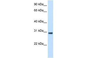 WB Suggested Anti-KCTD6 Antibody Titration:  5. (KCTD6 Antikörper  (N-Term))