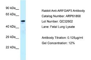 Western Blotting (WB) image for anti-ADP-Ribosylation Factor GTPase Activating Protein 3 (ARFGAP3) (C-Term) antibody (ABIN2788930)