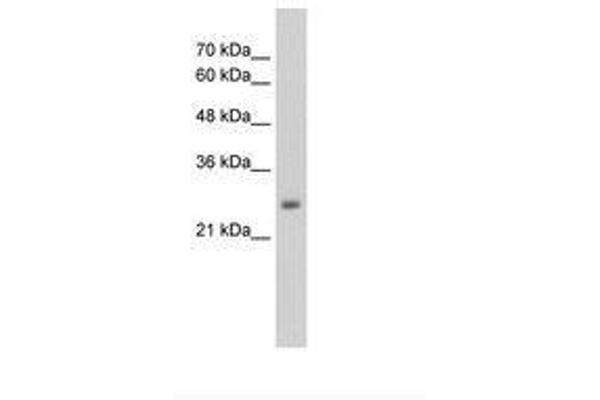 NMDA Receptor Synaptonuclear Signaling and Neuronal Migration Factor (NSMF) (AA 283-332) Antikörper