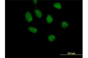 Immunofluorescence of purified MaxPab antibody to GATAD2B on HeLa cell. (GATAD2B Antikörper  (AA 1-593))