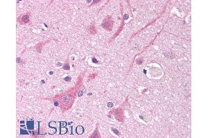 Immunohistochemistry (IHC) image for anti-Sodium Channel, Voltage-Gated, Type V, alpha Subunit (SCN5A) (Internal Region) antibody (ABIN185467)