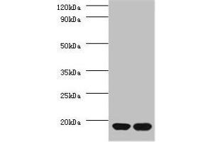 Western blot All lanes: RPS13 antibody at 2 μg/mL Lane 1: EC109 whole cell lysate Lane 2: 293T whole cell lysate Secondary Goat polyclonal to rabbit IgG at 1/15000 dilution Predicted band size: 18 kDa Observed band size: 18 kDa (RPS13 Antikörper  (AA 3-151))