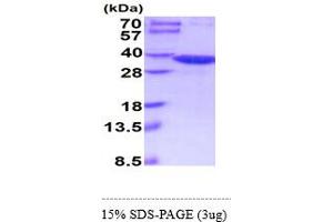 SDS-PAGE (SDS) image for Glycine N-Methyltransferase (GNMT) (AA 1-295) (Active) protein (His tag) (ABIN6388114)