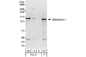 Western Blotting (WB) image for anti-Ubinuclein 1 (UBN1) (AA 1084-1134) antibody (ABIN7453236)