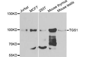 Western blot analysis of extracts of various cell lines, using TGS1 antibody. (TGS1 Antikörper)