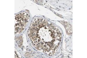 Immunohistochemical staining of human testis with TMCC2 polyclonal antibody  shows strong cytoplasmic positivity in cells in seminiferus ducts. (TMCC2 Antikörper)