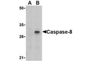 Western blot analysis of Caspase-8 in HT-29 cell lysate with AP30204PU-N Caspase-8 antibody (IN) at 1 μg/ml in (A) the presence or (B) the absence of blocking peptide.