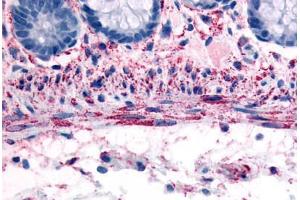 Human Smooth Muscle Cells (formalin-fixed, paraffin-embedded) stained with ADRA1B antibody ABIN213529 at 10 ug/ml followed by biotinylated goat anti-rabbit IgG secondary antibody ABIN481713, alkaline phosphatase-streptavidin and chromogen. (ADRA1B Antikörper  (C-Term))