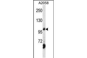 Western blot analysis in A2058 cell line lysates (35ug/lane). (AP2B1 Antikörper  (AA 517-546))