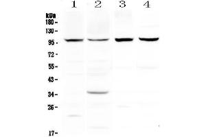 Western blot analysis of DYRK1A using anti-DYRK1A antibody . (DYRK1A Antikörper  (AA 38-269))