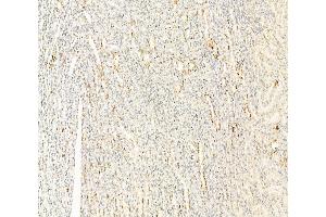 ABIN6260963 and ABIN6266517 at 1/100 staining Rat kidney tissue by IHC-P. (Connexin 43/GJA1 Antikörper  (Internal Region))