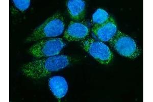 IF analysis of TIMM8A/DDP using anti-TIMM8A/DDP antibody (ABIN7600039). (TIMM8A/DDP Antikörper  (AA 14-97))