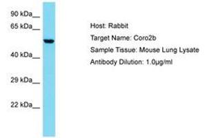 Image no. 1 for anti-Coronin, Actin Binding Protein, 2B (CORO2B) (AA 62-111) antibody (ABIN6750330) (CORO2B Antikörper  (AA 62-111))