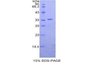 SDS-PAGE analysis of Human Dystrophin Protein.