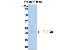 Western Blotting (WB) image for anti-Interleukin 7 Receptor (IL7R) (AA 48-217) antibody (ABIN1175191) (IL7R Antikörper  (AA 48-217))