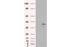 Image no. 1 for anti-Induced Myeloid Leukemia Cell Differentiation Protein Mcl-1 (MCL1) antibody (ABIN1499342) (MCL-1 Antikörper)