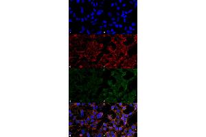 Immunocytochemistry/Immunofluorescence analysis using Mouse Anti-4-Hydroxynonenal Monoclonal Antibody, Clone 12F7 . (HNE Antikörper  (APC))