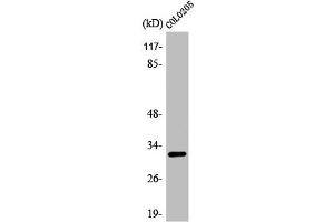 Western Blot analysis of COLO205 cells using APHC Polyclonal Antibody (ACER3 Antikörper  (Internal Region))