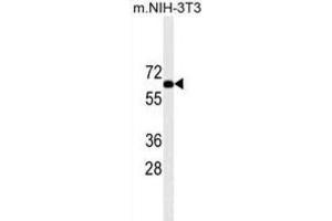 Western Blotting (WB) image for anti-Ribosomal Protein S6 Kinase, 70kDa, Polypeptide 2 (RPS6KB2) antibody (ABIN2909954) (RPS6KB2 Antikörper)