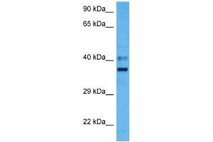 Host:  Mouse  Target Name:  PARD6A  Sample Tissue:  Mouse Liver  Antibody Dilution:  1ug/ml (PARD6A Antikörper  (N-Term))
